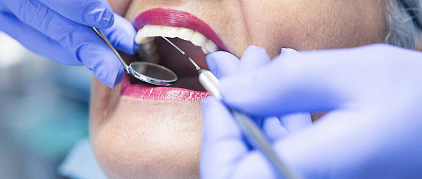 Best Chipped Tooth Repair Near Me  in Appomattox, VA